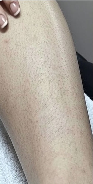 Legs at week 0