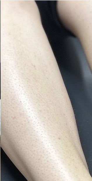Legs at week 3
