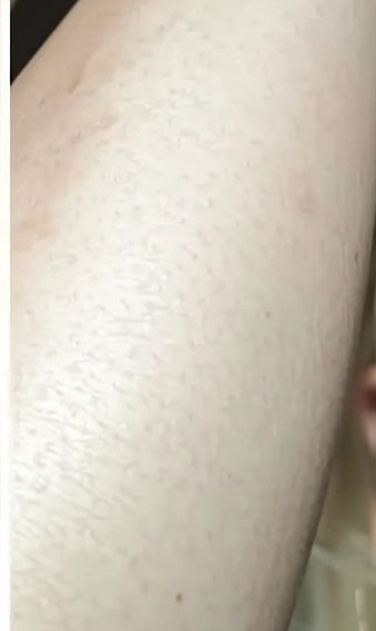 Underarm at week 4